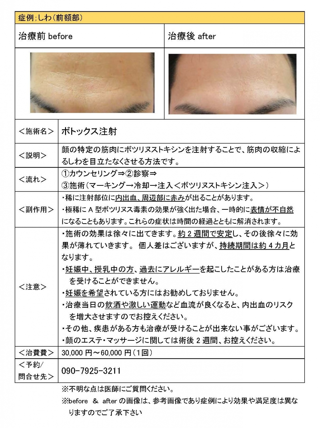 しわ、巻き爪、薄毛、血管奇形施術の症例写真を掲載します 